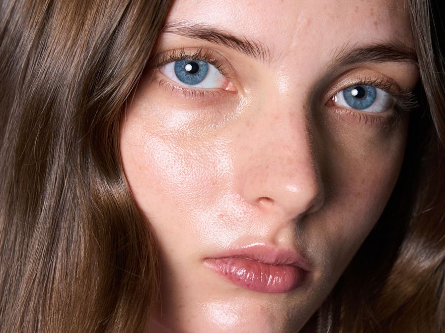 How to get rid of milia, and everything to know about those tiny white bumps